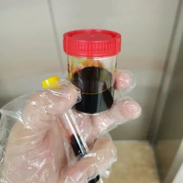 急性肝衰竭！兩兄弟誤吃這種菌 專家提醒